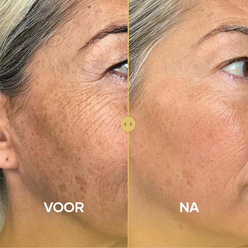 ÖKAD NATURLIG KOLLAGENPRODUKTION