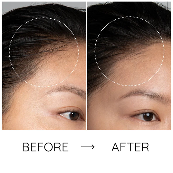 The gentle boost your hair deserves, healthier, shinier, and fuller.